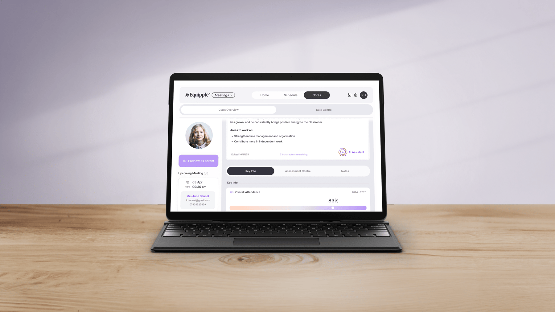 Equipple Surface Pro